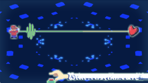 Screenshot of the level Supraventricular Tachycardia